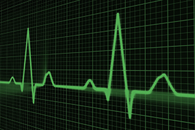 Der Herzaktivität optisch und elektrisch auf der Spur