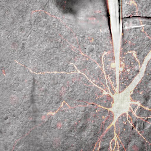 Patch-clamp recording from a basal dendrite of a layer 5 pyramidal neuron